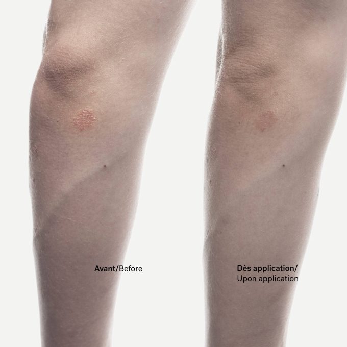 Dry Patch Relief Cream